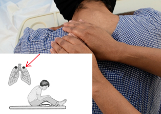 Introduction to Chest Physiotherapy (CPT) and its Techniques