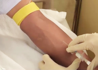 Peripherally Inserted Venous Catheter (PIVC) Cannulation, IV Infusion Therapy and Cannula Removal